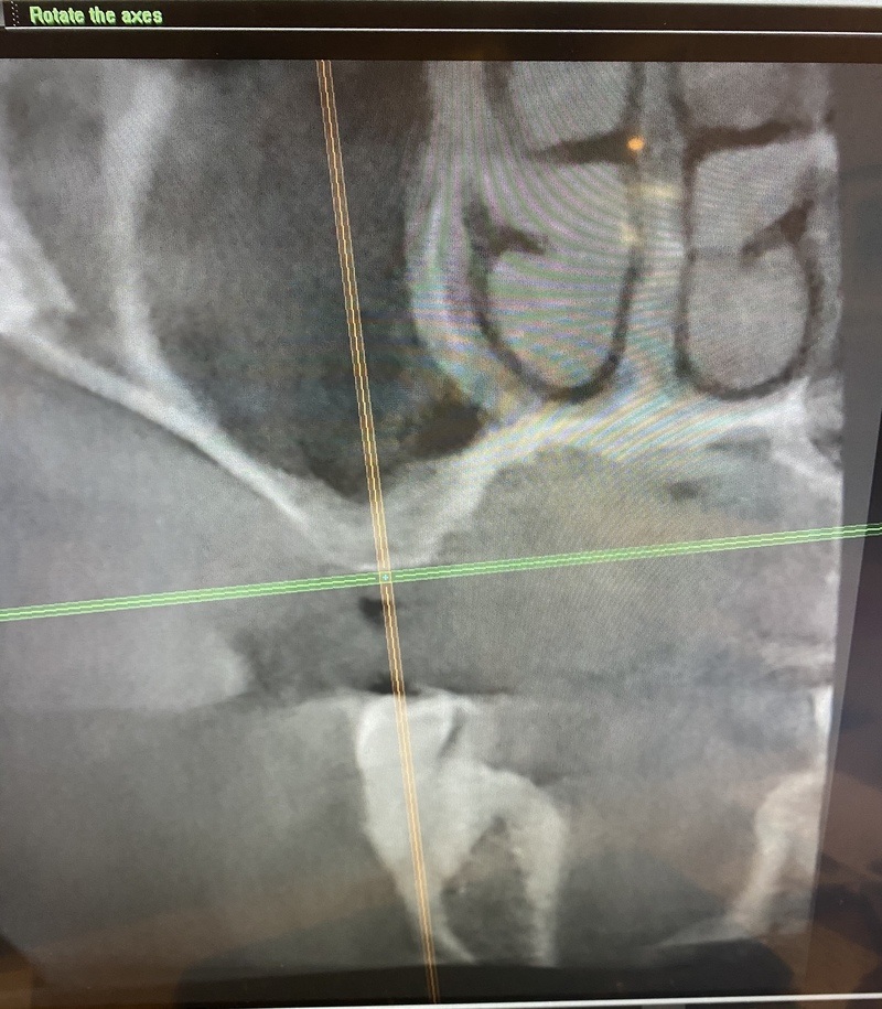 TONY MENENDEZ, DDS, MAGD TONY MENENDEZ, DDS, MAGD