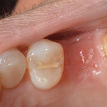 TONY MENENDEZ, DDS, MAGD TONY MENENDEZ, DDS, MAGD