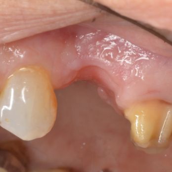 TONY MENENDEZ, DDS, MAGD TONY MENENDEZ, DDS, MAGD