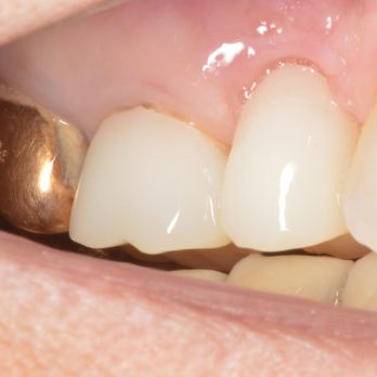 TONY MENENDEZ, DDS, MAGD TONY MENENDEZ, DDS, MAGD