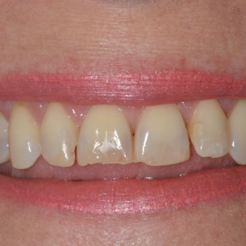 TONY MENENDEZ, DDS, MAGD TONY MENENDEZ, DDS, MAGD