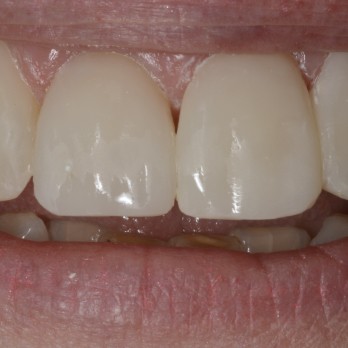 TONY MENENDEZ, DDS, MAGD TONY MENENDEZ, DDS, MAGD
