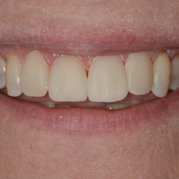 TONY MENENDEZ, DDS, MAGD TONY MENENDEZ, DDS, MAGD