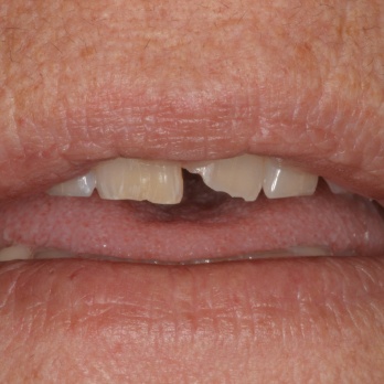 TONY MENENDEZ, DDS, MAGD TONY MENENDEZ, DDS, MAGD
