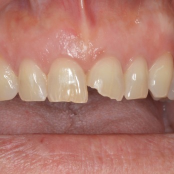 TONY MENENDEZ, DDS, MAGD TONY MENENDEZ, DDS, MAGD