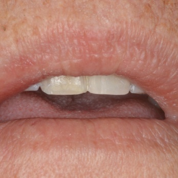 TONY MENENDEZ, DDS, MAGD TONY MENENDEZ, DDS, MAGD