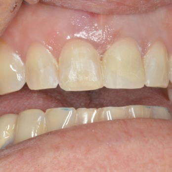 TONY MENENDEZ, DDS, MAGD TONY MENENDEZ, DDS, MAGD