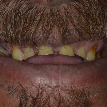 TONY MENENDEZ, DDS, MAGD TONY MENENDEZ, DDS, MAGD