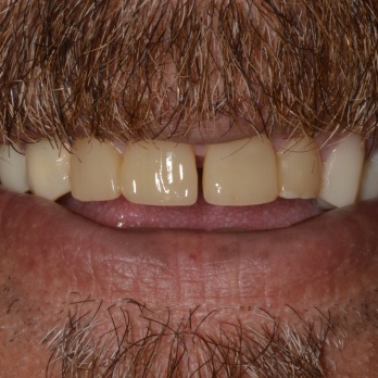 TONY MENENDEZ, DDS, MAGD TONY MENENDEZ, DDS, MAGD