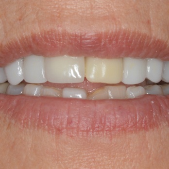 TONY MENENDEZ, DDS, MAGD TONY MENENDEZ, DDS, MAGD