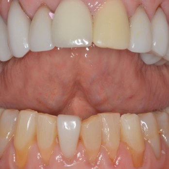 TONY MENENDEZ, DDS, MAGD TONY MENENDEZ, DDS, MAGD