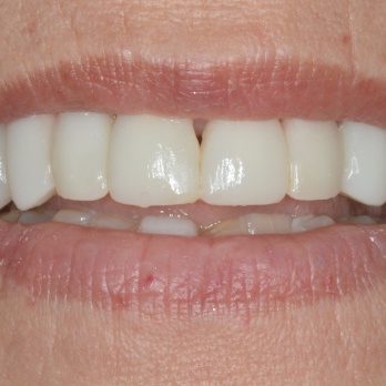 TONY MENENDEZ, DDS, MAGD TONY MENENDEZ, DDS, MAGD