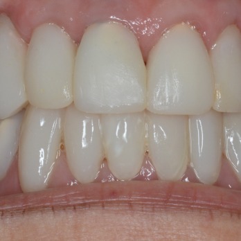 TONY MENENDEZ, DDS, MAGD TONY MENENDEZ, DDS, MAGD