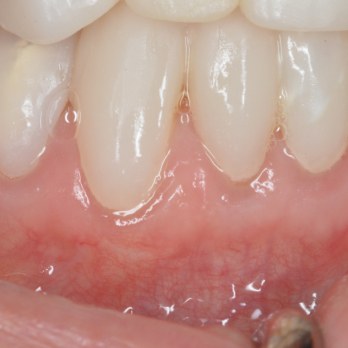 TONY MENENDEZ, DDS, MAGD TONY MENENDEZ, DDS, MAGD