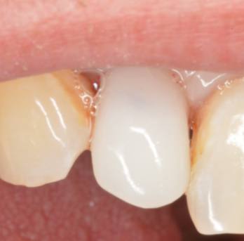 TONY MENENDEZ, DDS, MAGD TONY MENENDEZ, DDS, MAGD