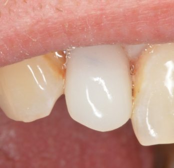 TONY MENENDEZ, DDS, MAGD TONY MENENDEZ, DDS, MAGD