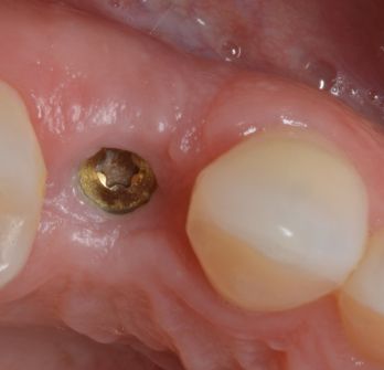 TONY MENENDEZ, DDS, MAGD TONY MENENDEZ, DDS, MAGD