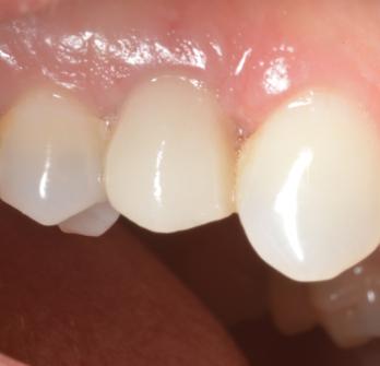 TONY MENENDEZ, DDS, MAGD TONY MENENDEZ, DDS, MAGD