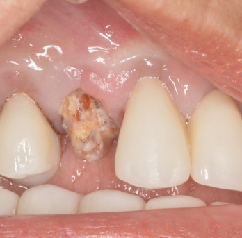 TONY MENENDEZ, DDS, MAGD TONY MENENDEZ, DDS, MAGD