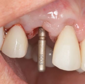 TONY MENENDEZ, DDS, MAGD TONY MENENDEZ, DDS, MAGD