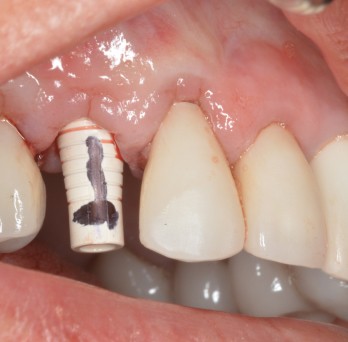 TONY MENENDEZ, DDS, MAGD TONY MENENDEZ, DDS, MAGD