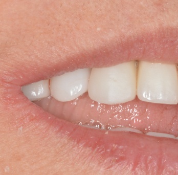TONY MENENDEZ, DDS, MAGD TONY MENENDEZ, DDS, MAGD