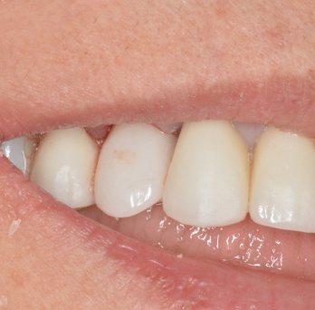 TONY MENENDEZ, DDS, MAGD TONY MENENDEZ, DDS, MAGD
