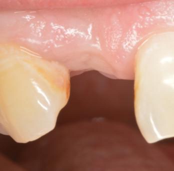 TONY MENENDEZ, DDS, MAGD TONY MENENDEZ, DDS, MAGD