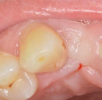 TONY MENENDEZ, DDS, MAGD TONY MENENDEZ, DDS, MAGD