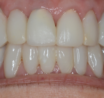 TONY MENENDEZ, DDS, MAGD TONY MENENDEZ, DDS, MAGD