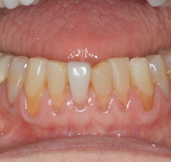 TONY MENENDEZ, DDS, MAGD TONY MENENDEZ, DDS, MAGD