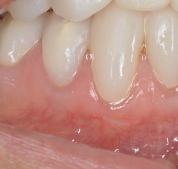 TONY MENENDEZ, DDS, MAGD TONY MENENDEZ, DDS, MAGD